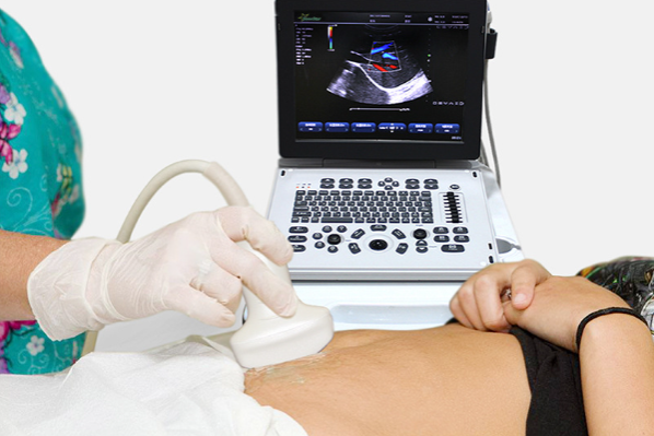 B超機(jī).png B超機(jī).png